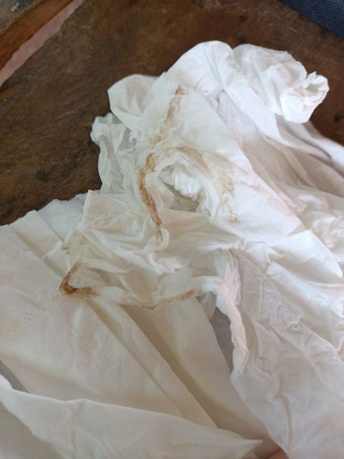 มีคล้ายๆเป็นมูกแต่ไม่เยอะยังไม่ปวดท้อง ตอนนี้ท้อง38วีค 4วันควรไปหาหมอไหม