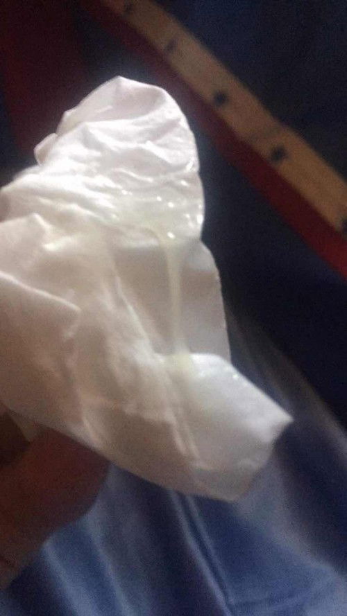 มีอะไรใสๆเเบบนี้อันตรายไหมบงบอกอะไร