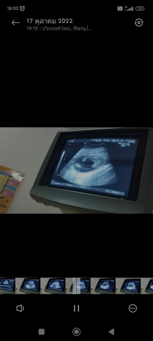 ดูเพศไม่ออก