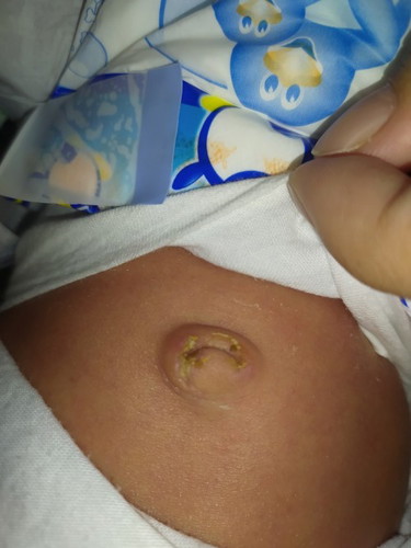 Pusod ni baby