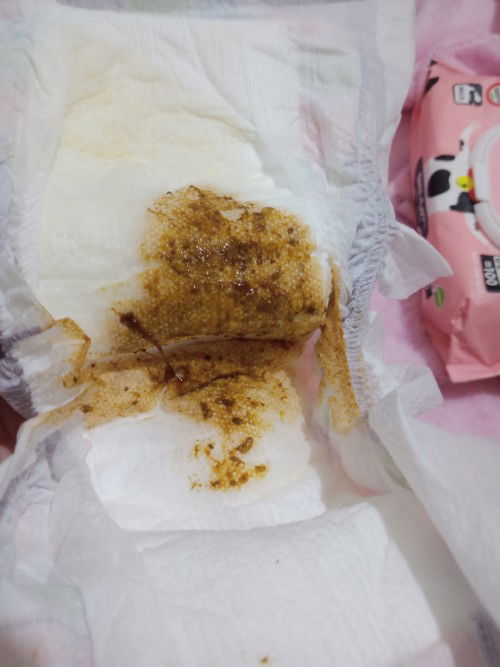 Mix feeding sa bonna