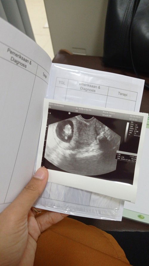 Awal USG transvaginal