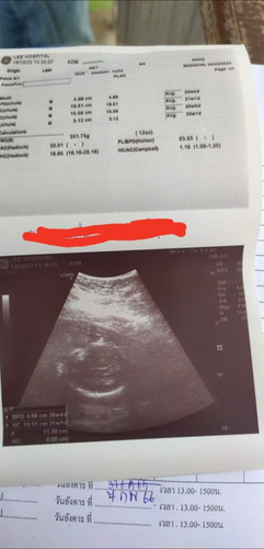 ตั้งครรภ์ได้5เดือนแล้วแต่ไม่เห็นรูปร่างเด็ก ถือว่าปกติไหมคะ