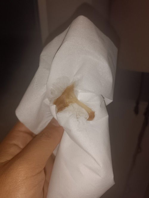 มีมูกสีน้ำตาลไหลออกมาหลังตรวจภายในแบบนี้อีกกี่วันคลอดคะ