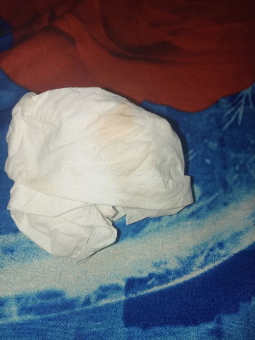 Keluar flek coklat bening saat usia kehamilan 9week