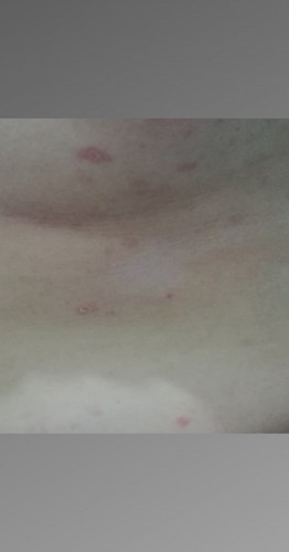 Ano po kayang rashes to?
