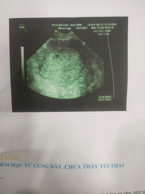 Trước kinh que 2 v nhưng  giờ thử lại 1v