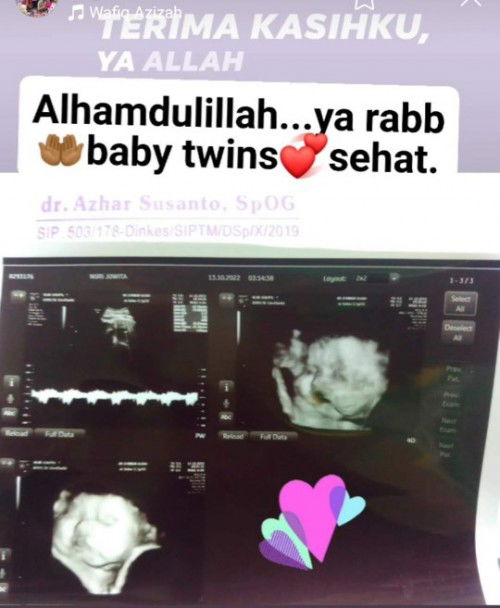 MasyaAllah tabarakallah.... Hello jagoan kembarku, bantu mama untuk selalu kuat terus yaa 💞