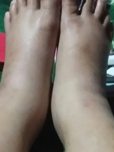 Trimester 3 mulai dari paha ampe kaki bengkak, trus selangkangan paha gatal, merah2 karna gesekan