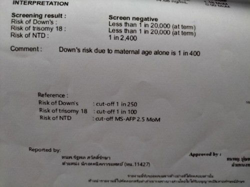 ผลตรวจ Down's