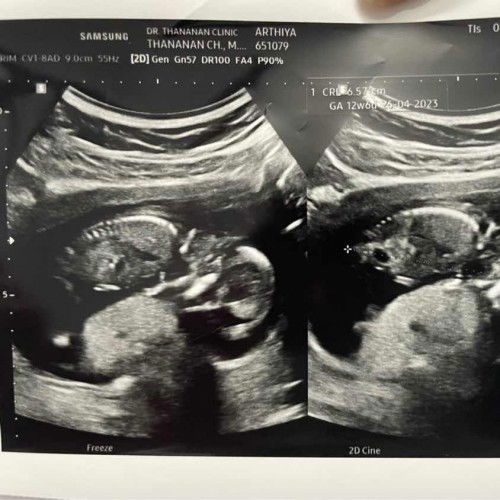 เพศลูกจะเพศชายรึหญิง