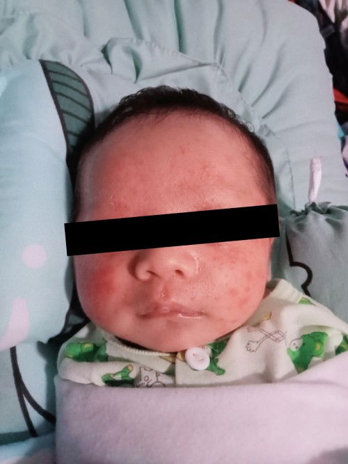 ผิวหน้าเด็ก