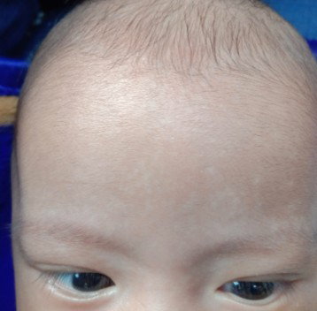 kulit bayi