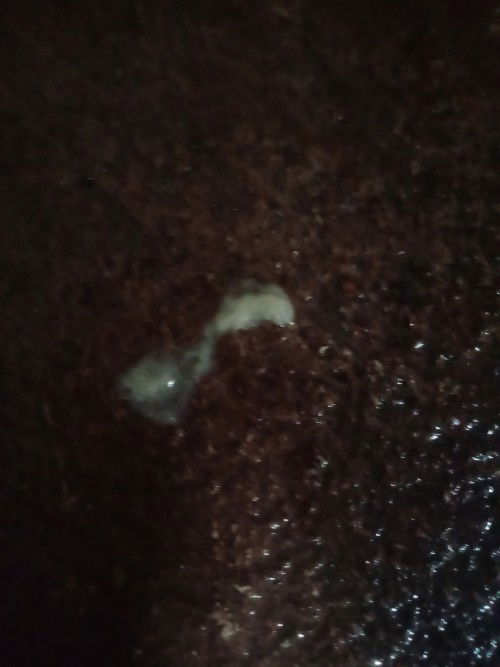 38w6d แล้ว ฉี่เสร็จแล้วมีแบบนี้ออกมา