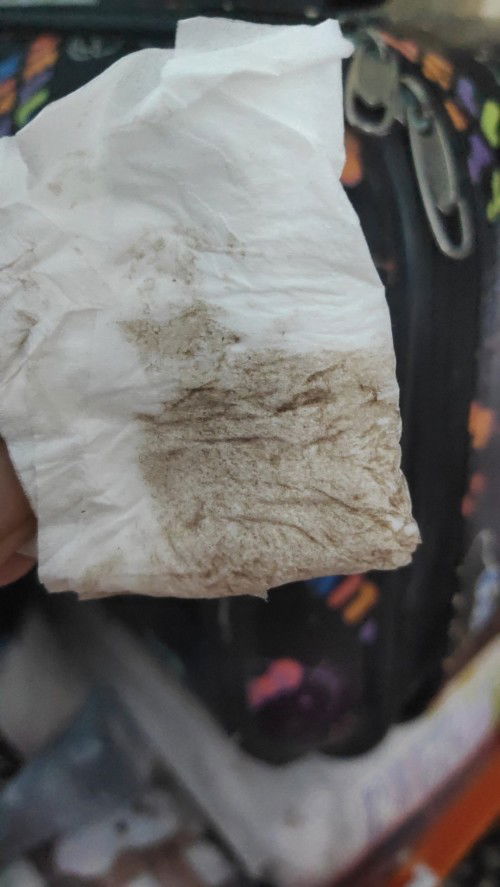 39+3w เมื่อวานหมอกระตุ้นปากมดลูกกลับมามีเลือดออกคล้าย ปจด.วันนี้เอาทิชชูซับเป็นสีน้ำตาลต้องไปรพไหม