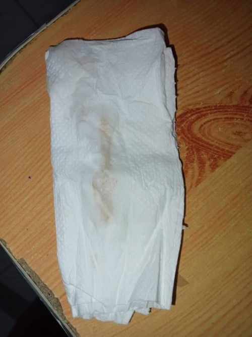 Light brown discharge