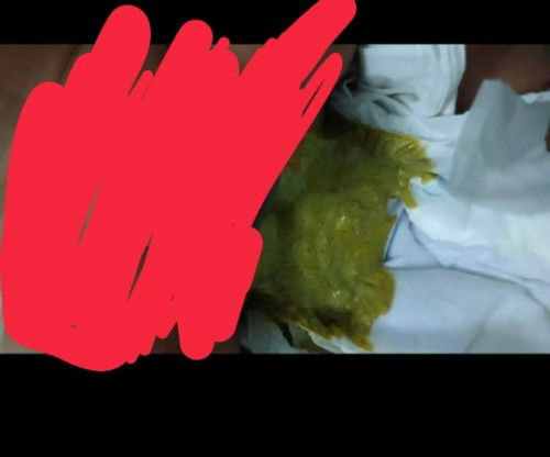 Najis baby hijau