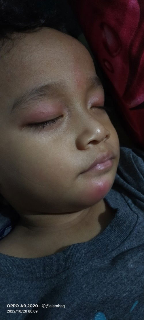 ADA YG TAU INI SAKIT APA.