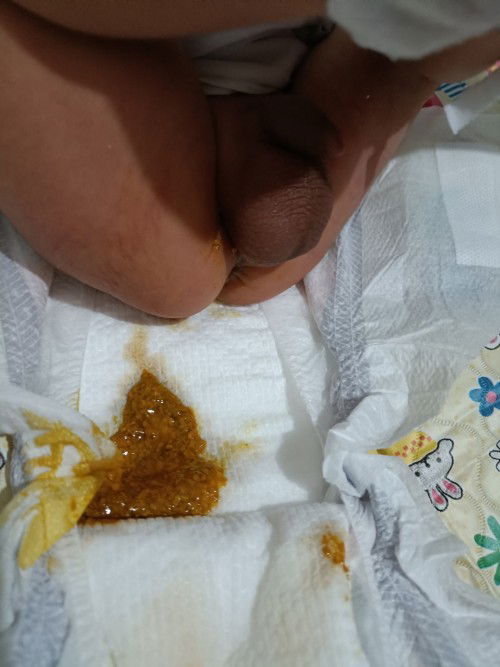 Pasintabi po : poop ni baby