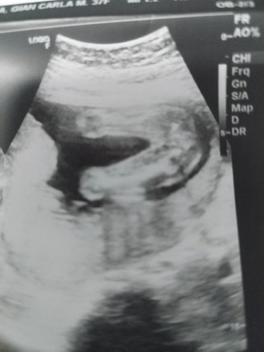 mga mi ask ko lang kung ano gender ni baby? base kasi sa ultrasound ko 70% lang n girl sya. 21 weeks