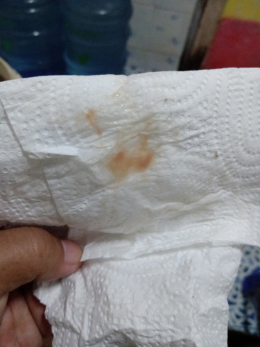 ควรไปหาหมอเลยไหมค่ะ