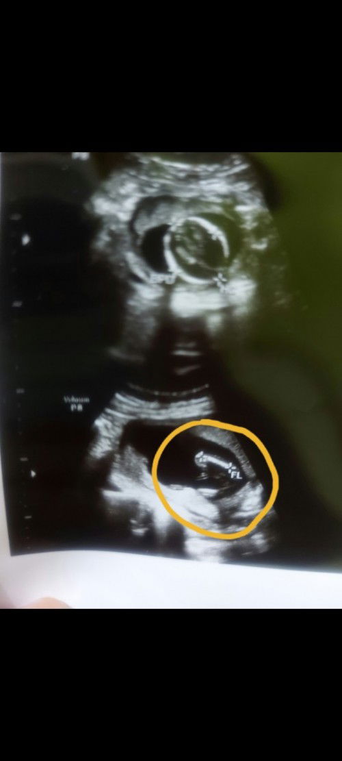 Hasil USG JK perempuan