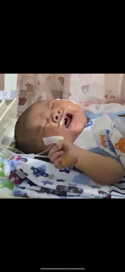 Gusi bayi renggang