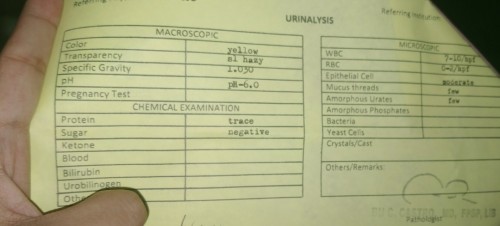 Urinalysis test