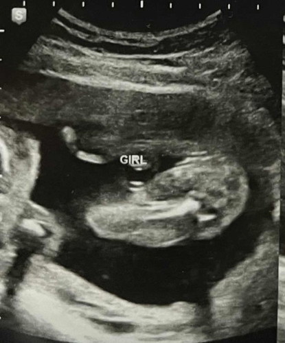 baby's gender