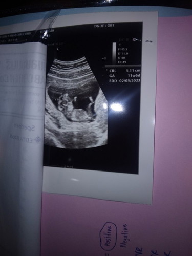 น้องเพศไหนคะ