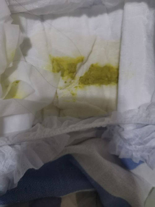 Lactum users po baby ko ngayon po oct 26 pa siya mag 1 kaso pinalitan ko agad ng lactum 1-3