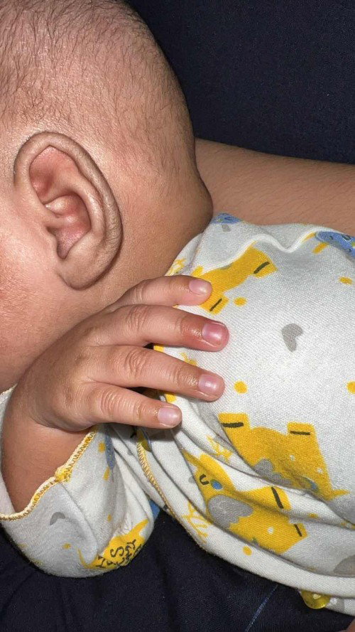 Jari bayi merah dan bengkak
