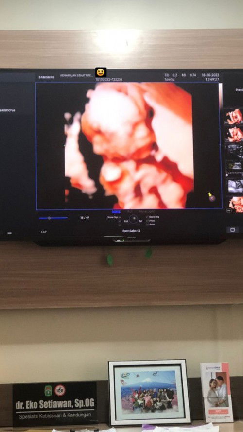 HAPPY NEMU DOKTER SPOG SEDETAIL DOKTER FETO. MURAH PULAAA 🥰