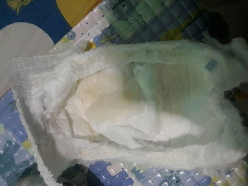 Bun aku pakek mamy pokoroyalsoft yg pant . Warna urinenya kok jadi gt ya warnanya apakah normal