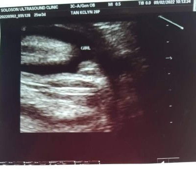 25weeks last ultrsound ko ask ko lang mga mamsh di na kaya magbabago ang gender ni baby?