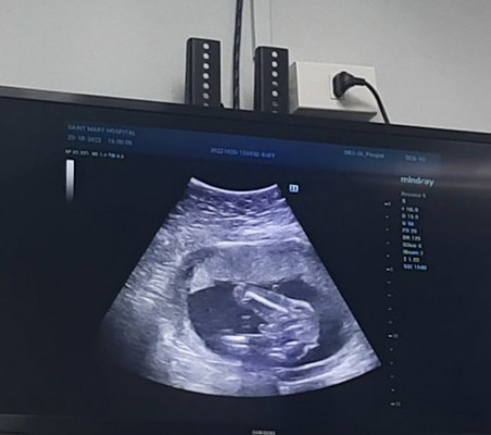 ขอเสียงทีมคลอดเดือนมีนาคมค่ะ🤰
