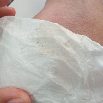 Seputar tanda lahiran