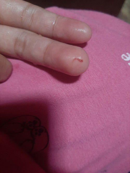 Kandungan saya 11w 1h bun, saya kurang lebih 1 minggu ini BAB nya warna item dan ada keputihan juga