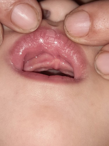 Teething??