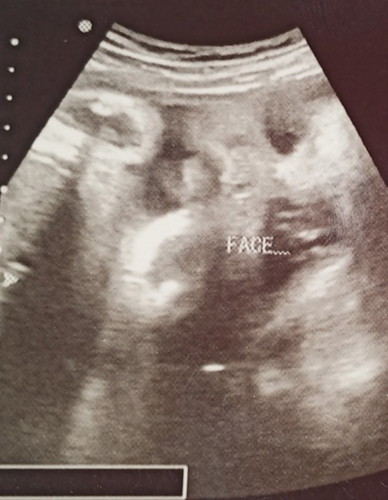Share ko lng baby boy ko