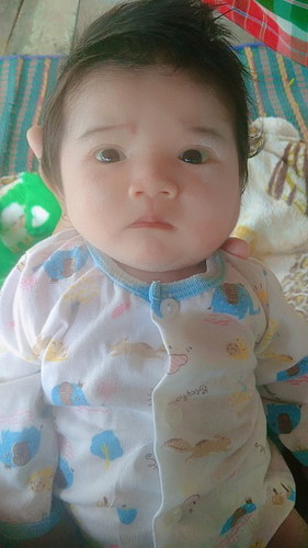 ลูกกินนมผงแล้วไม่อึ