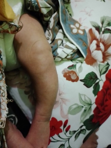 Normal /wajar gak ya