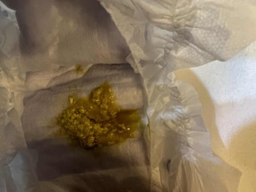 Baby poop formula fed