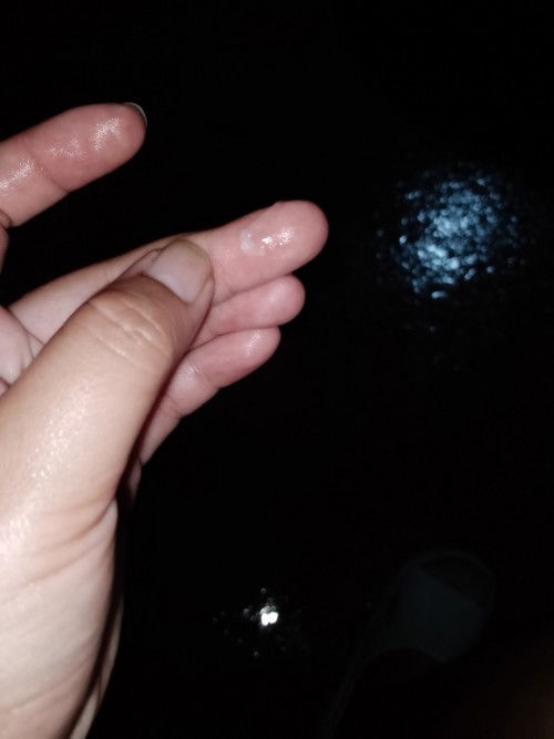 ขอสอบถามหน่อยค่ะ ตอนไปฉีแล้วล้างรุ้สึกว่ามันลื่นๆ คืออะไรค่ะ ตอนนี้ได้8 เดือนกับ4 วันค่ะ