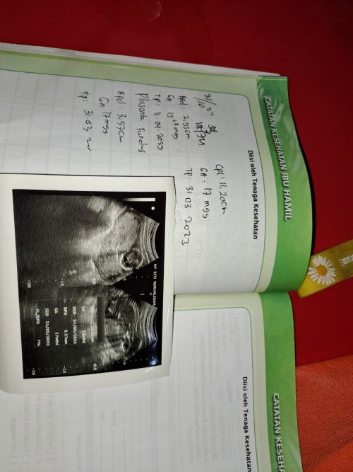 Jenis kelamin uk 17 minggu