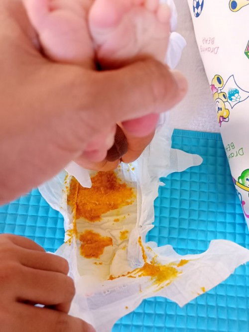 Watery na parang sipon na poop ni Newborn baby