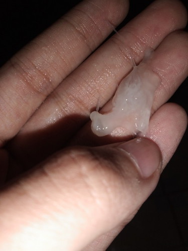Mucus plug ba?