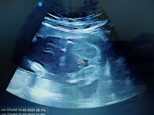 hai mommy , mata mommy2 nampak ni girl or boy ?