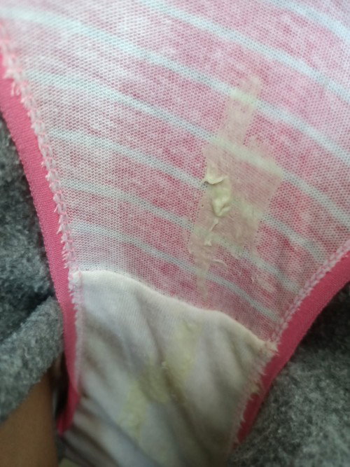 Ask ko lang po?Naka ranas din kayo na ganito discharge 29weeks nako.
