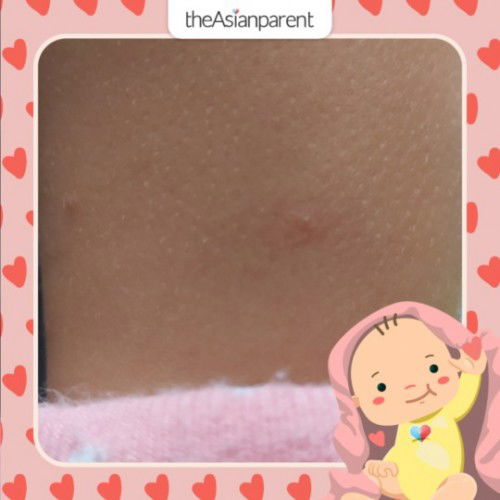 anopo kaya yan butlig na parang may tubig sa loob, konti lng nmn yan lng nmn kaso parang my tubig e